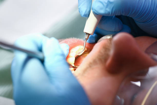 Best Emergency Dental Care for Broken or Chipped Teeth in Okauchee Lake, WI